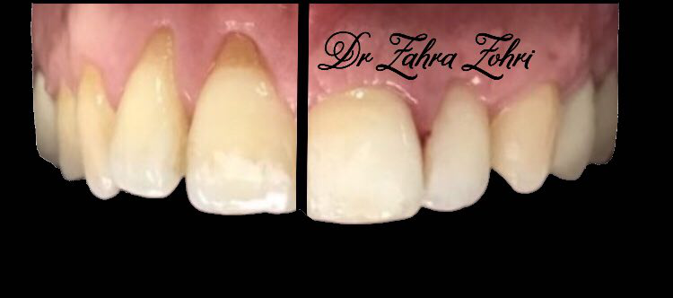استفاده از دندانپزشکی دیجیتال در مطب دکتر زهرا ظهری متخصص جراحی لثه و ایمپلنت و لیزر در دندانپزشکی